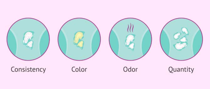 Abnormal vaginal discharge