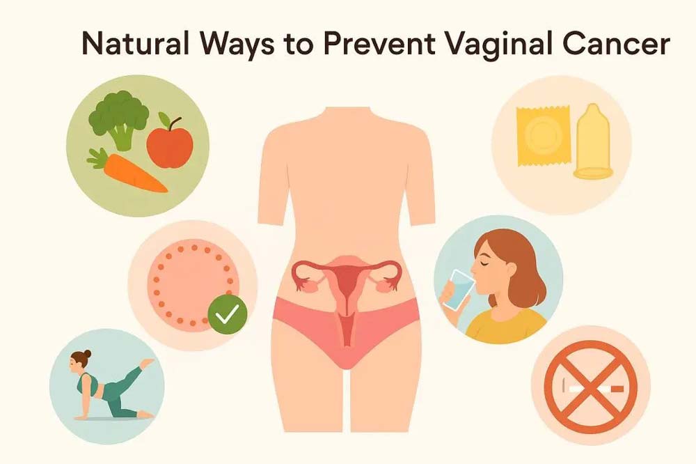 How to prevent vaginal infections