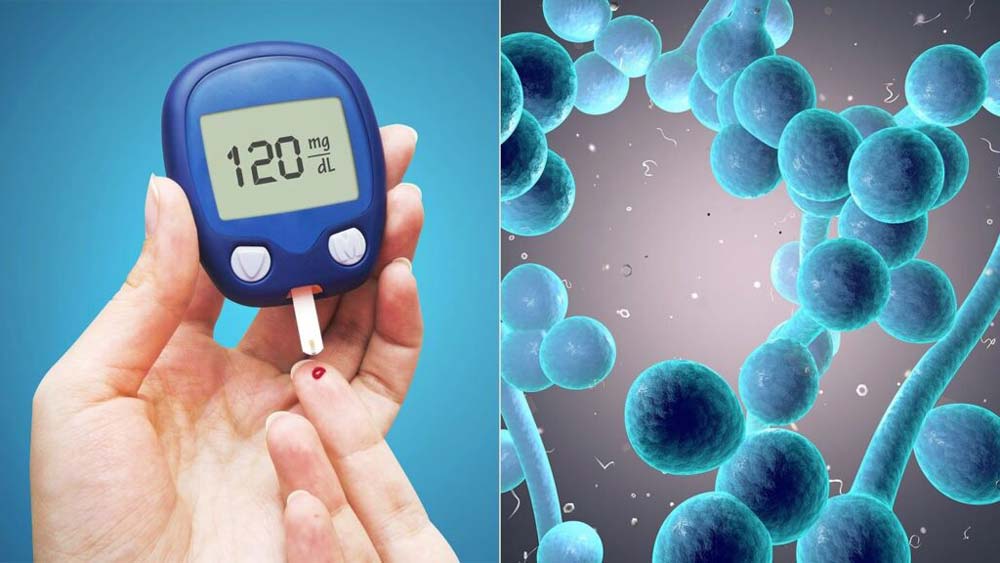 Uncontrolled diabetes and vaginal infections