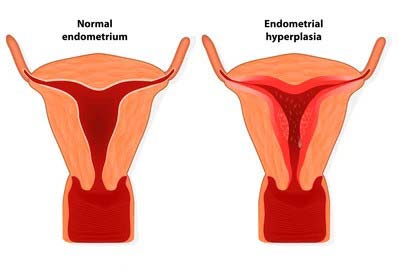 How can a uterine infection cause hormonal problems