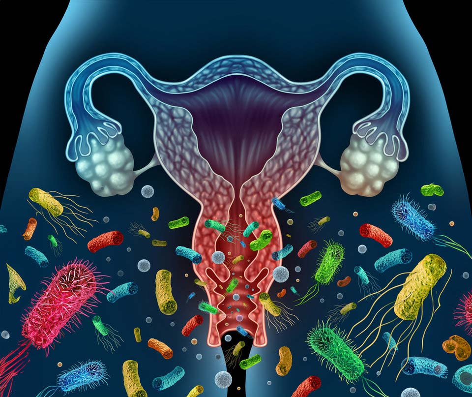 آنتی بیوتیک و عفونت قارچی: چگونه آنتی بیوتیک ها باعث عفونت زنان می شوند؟ 2 Vaginal microbiome