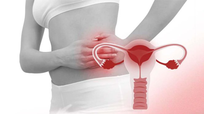 Pelvic inflammatory disease
