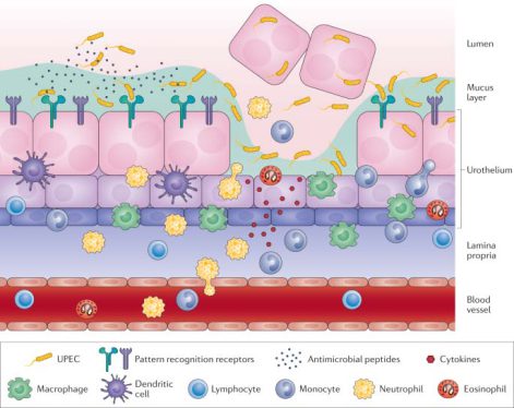 آیا عفونت های مکرر زنان میتواند نشانهی ضعف سیستم ایمنی باشد؟ 4 The relationship between the immune system and recurrent infections in women
