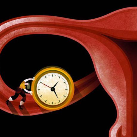 تغییرات هورمونی یائسگی و عفونت های زنان