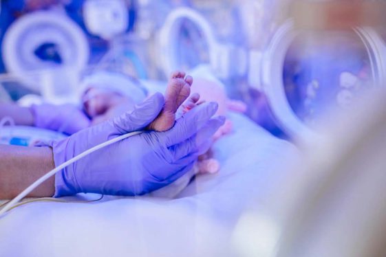 Premature baby